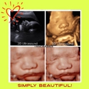 A New Conception 4D Ultrasound Studio - Medical Imaging Services