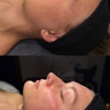 Ashley Skin Esthetics gallery