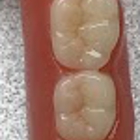 Apex Denture Studio