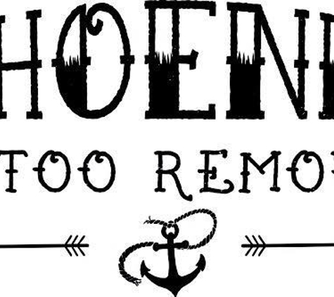 Phoenix Tattoo Removal - Phoenix, AZ