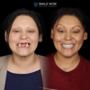 Smile Now Milwaukee Dentures and Implants gallery