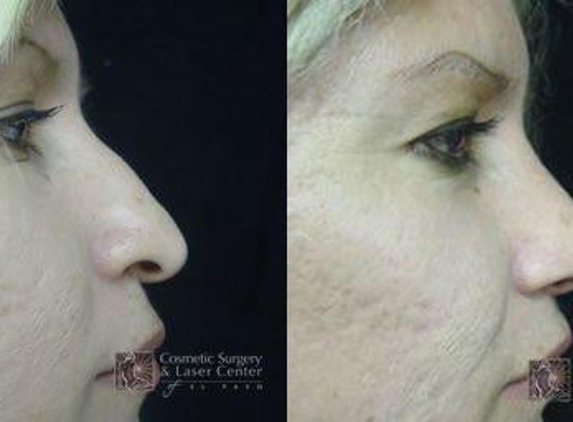 Cosmetic Surgery & Laser Center of El Paso - El Paso, TX