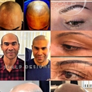 Scalp Designs - Hair Replacement