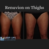 Laser Lipo and Vein Center gallery