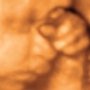 3D Baby Ultrasound Sonograms