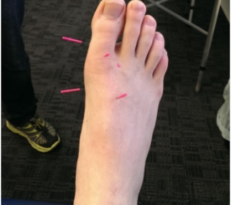 Podiatry Care Barossa Valley - Nuriootpa, SA
