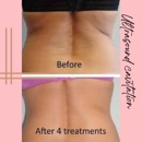 Skulpted Skin the Body Contouring Specialist - Physicians & Surgeons, Dermatology