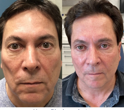 Island Plastic Surgery - Mineola, NY