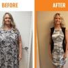 Greensboro Weight Loss gallery