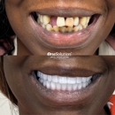 OneSolution Dental Implant Centers - Implant Dentistry