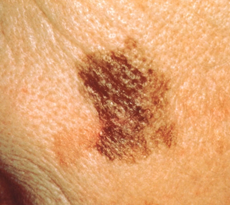 Port Macquarie Skin Cancer Clinic - Port Macquarie, NSW