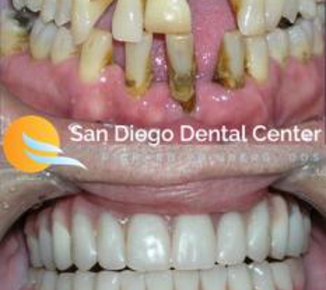 San Diego Dental Center - La Mesa, CA