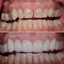 Dentistry at Pelham Pointe - Teeth Whitening Products & Services