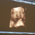 First Glance 3D/4D Ultrasound Studio