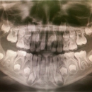 Boise Oral and Maxillofacial Surgery - Oral & Maxillofacial Surgery