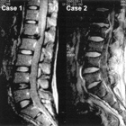 Miami Open MRI