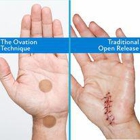 Ovation Hand Institute - Green Bay