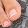 Laser Nail Therapy Clinic-Toenail Fungus Treatment Tampa FL gallery