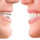 Thomas Iverson, DDS, MS