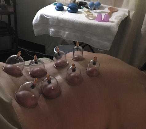 Natural Relaxation Massage Studio - Killeen, TX. Cupping Therapy