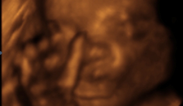Sneak-A-Peek Prenatal Imaging of Mobile - Mobile, AL