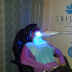 SmileLabs of Pleasanton Cosmetic Teeth Whitening