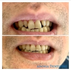 Adonia Dentistry Houston