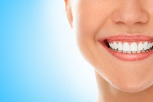 Veneers vary in cost, but resin ones are cheaper than porcelain.