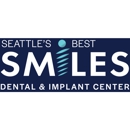 Seattle's Best Smiles - Implant Dentistry