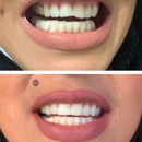 Dr. Claudia Piccolo, DDS - Dentists