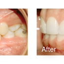 New York Fashion Braces - Dental Clinics