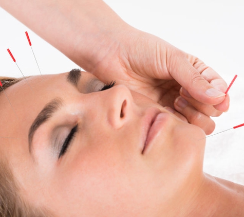 Awakening Balance Acupuncture - Northglenn, CO. Cosmetic Acupuncture