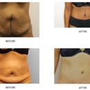 Liposuction and Cosmetic Surgery Institute - Physicians & Surgeons, Plastic & Reconstructive