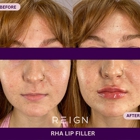 Reign Medical Aesthetics and Wellness