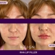 Reign Medical Aesthetics and Wellness
