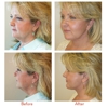 Utah Facial Plastics & UFP Aesthetics gallery