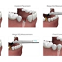 Elevated Oral & Implant Surgery, P.C.