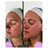 The Med Spa of Kingwood gallery