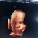 Babyface 4D Ult - Medical Imaging Services