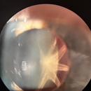 Sheri Rowen, M.D. - Physicians & Surgeons, Ophthalmology