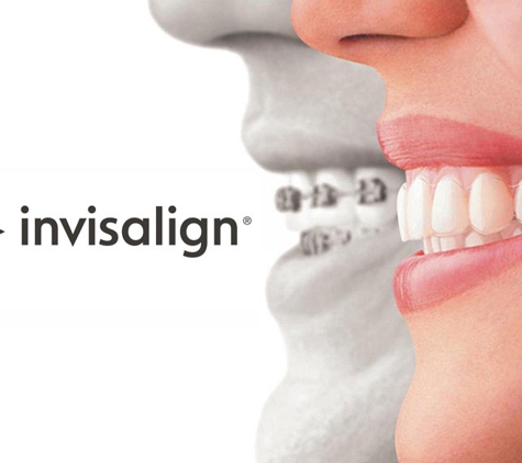 iHeartDDS - Santa Clarita, CA. Invisalign starts $3500