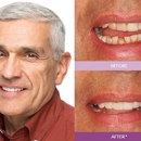 Bright Star Dental - Implant Dentistry