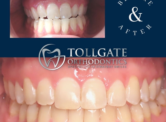 Tollgate Orthodontics - Warwick, RI