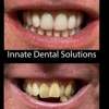 Innate Dental Solutions gallery