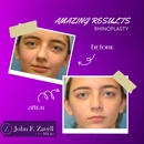 John F. Zavell, MD, FACS - Skin Care