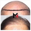 MAXIM Hair Restoration - Hair Stylists
