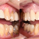 Foundations Family Dentistry - Implant Dentistry