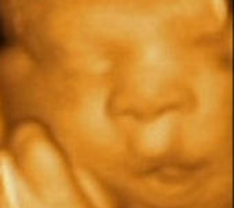 A Baby Visit 4D Ultrasound - Orange, CA