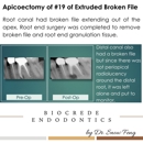 Biocrede Endodontics - Endodontists
