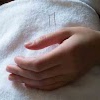 Acupuncture NYC gallery